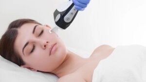 CO2 Laser Skin Resurfacing